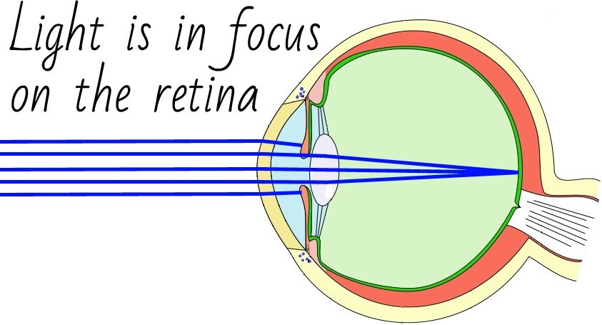 Light Is In Focus On The Retina