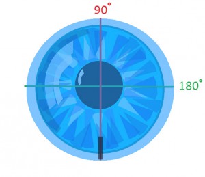Aligned Contact Lens