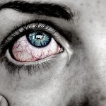 Top 8 Reasons You're Getting Red Eyes From Contacts