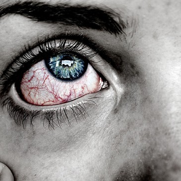 Top 8 Reasons You’re Getting Red Eyes From Contacts