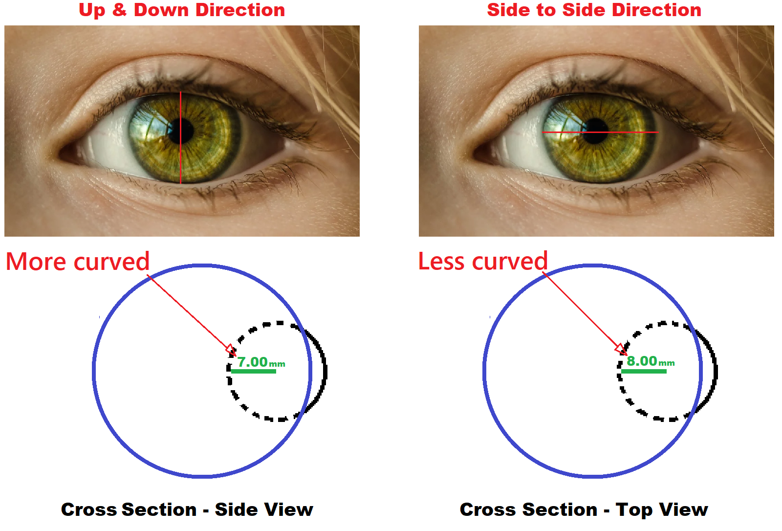 diagram showing two different corneal curvatures in astigmatism